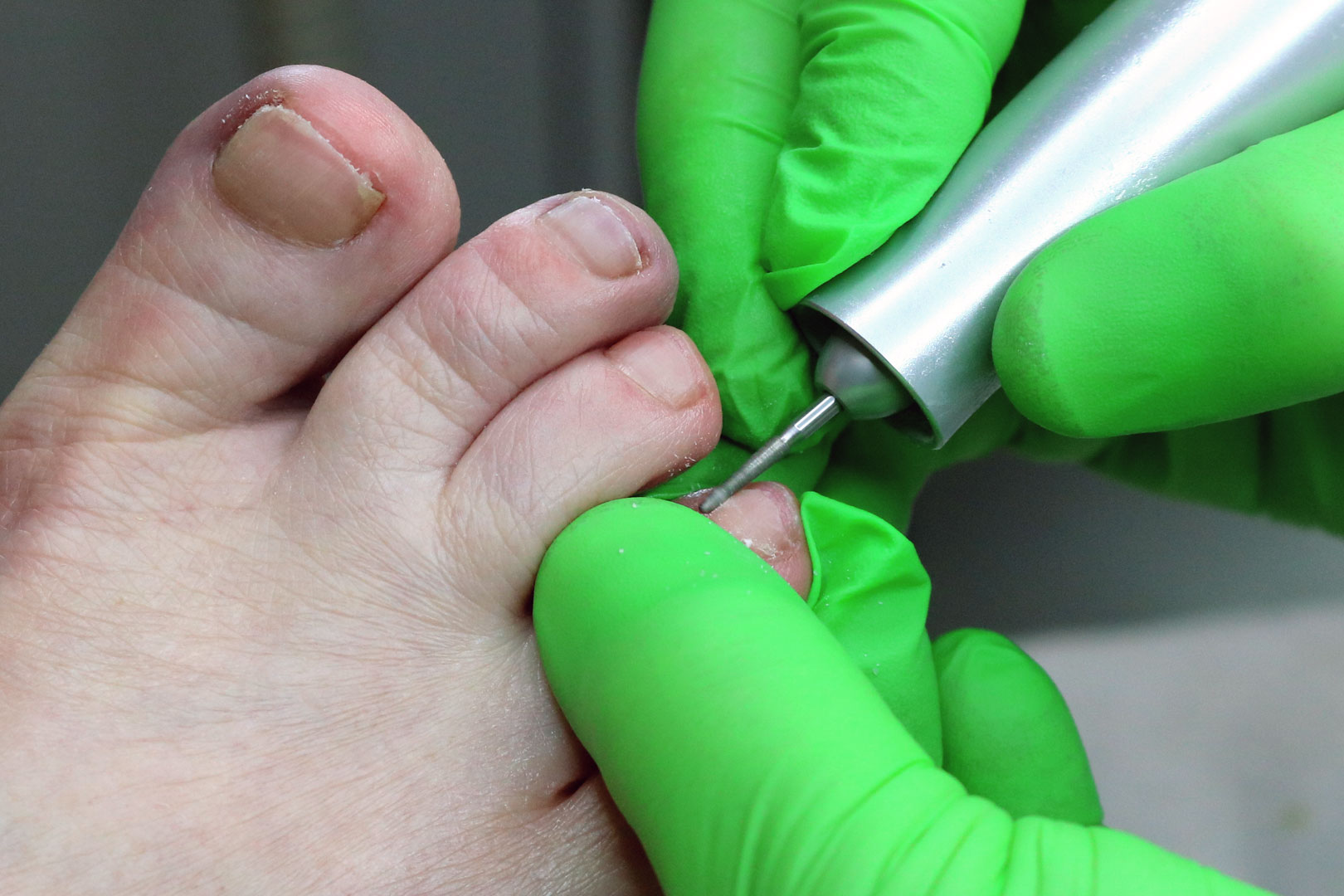 Fusspflege als Hausbesuch in Zürich bei der fachgerechten Behandlung der Zehennägel