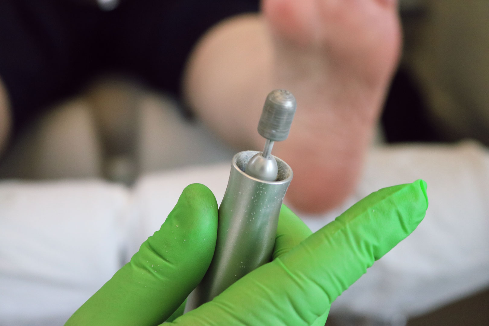 Instrument zur Behandlung von Hornhaut und Hühneraugen bei der Fusspflege in Zürich