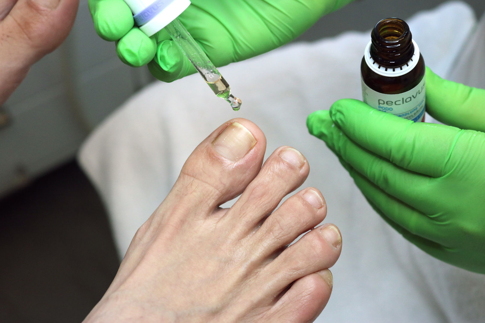 Klassische Fusspflege in Zürich Wipkingen mit Pflegeöl und fachgerechter Nagelbehandlung